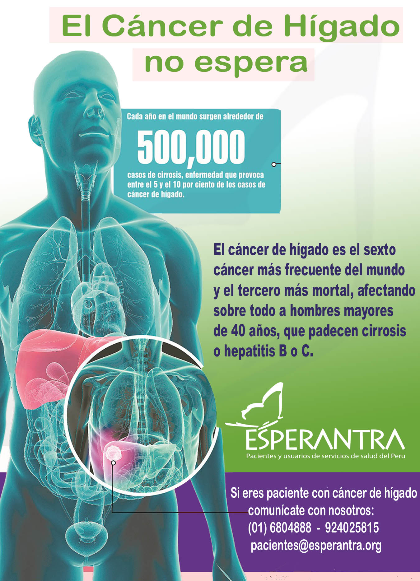CANCER DE HIGADO 2.jpg