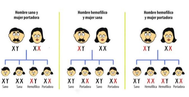 Hemofilia genetica