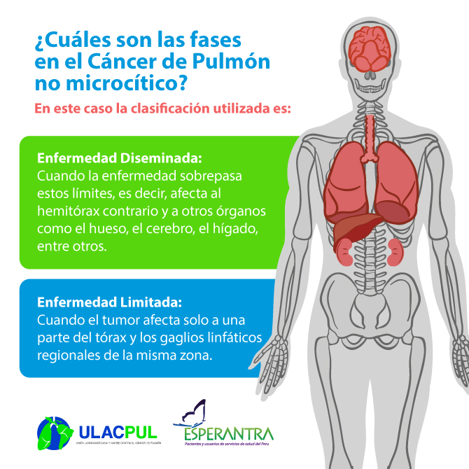 Dia Cancer de Pulmon web2