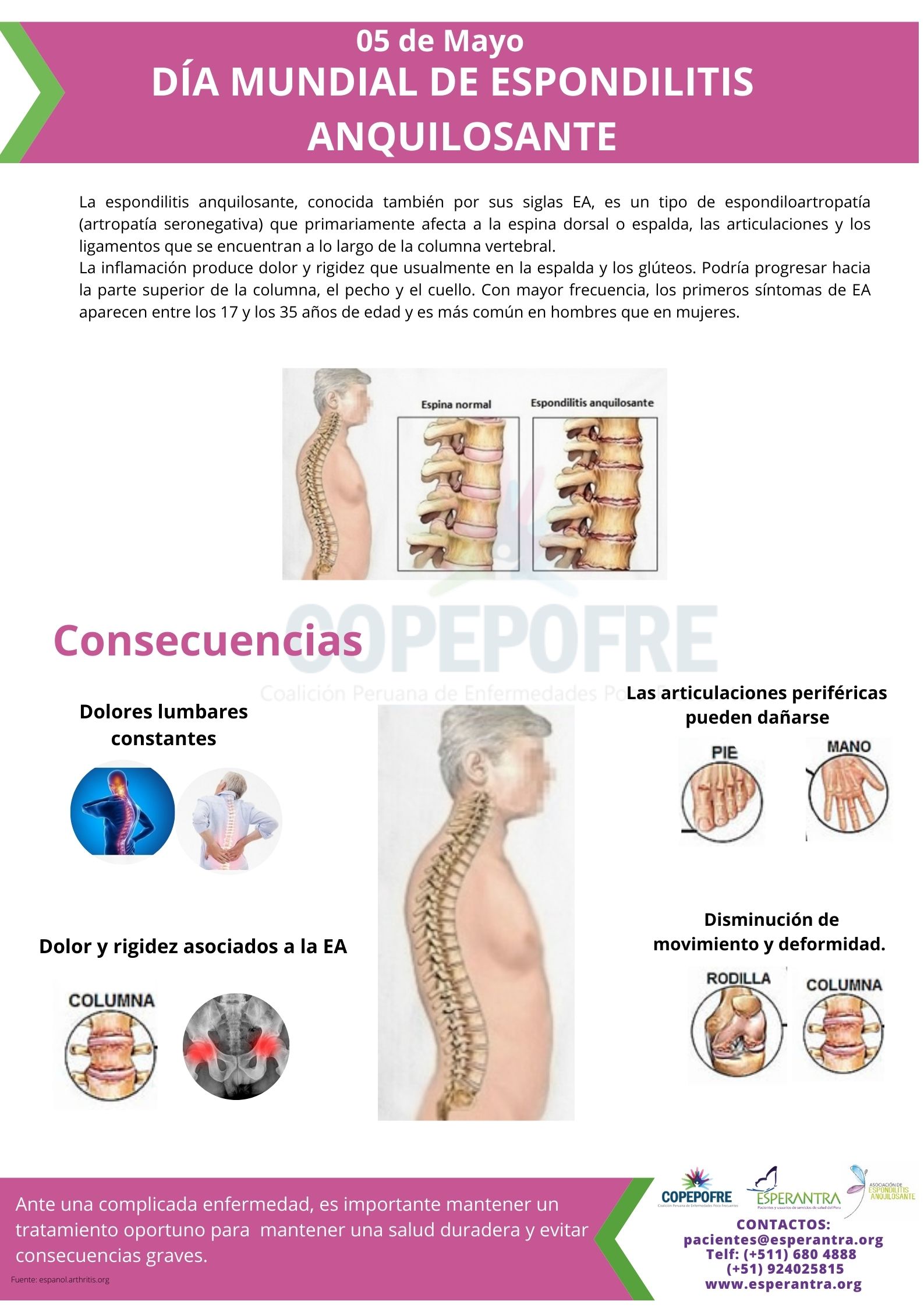 espondilitis 2021 (2).jpg